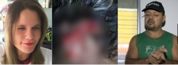 Desconfiado de traio, homem corta cabelo e orelhas da mulher em PE