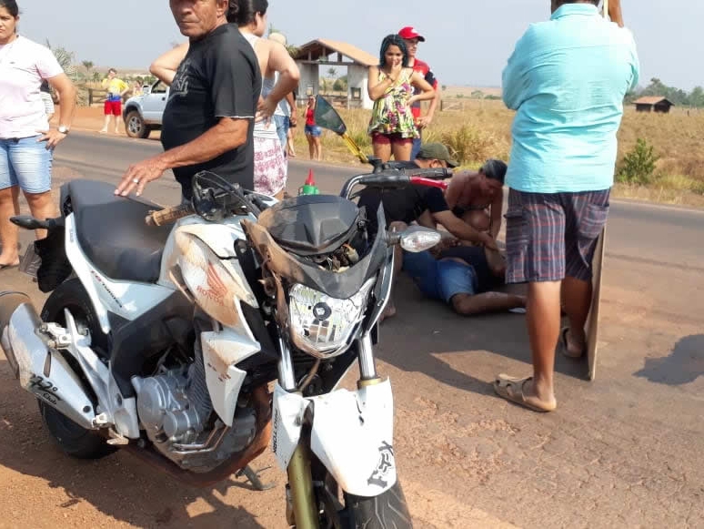 Batida frontal entre duas motos deixa um dos condutores com afundamento de crnio e afundamento da face.