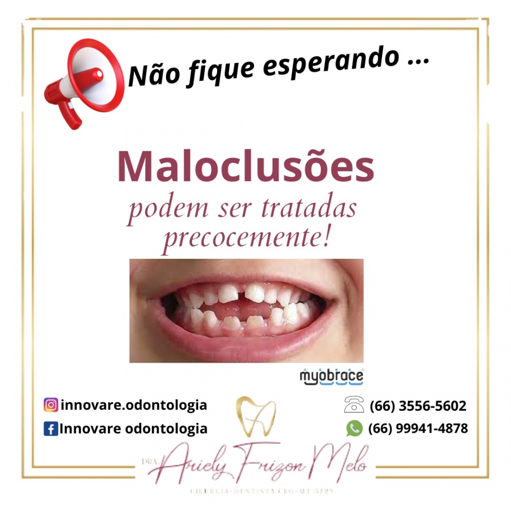 Dentista chama ateno para riscos da maloculuso dentaria em crianas