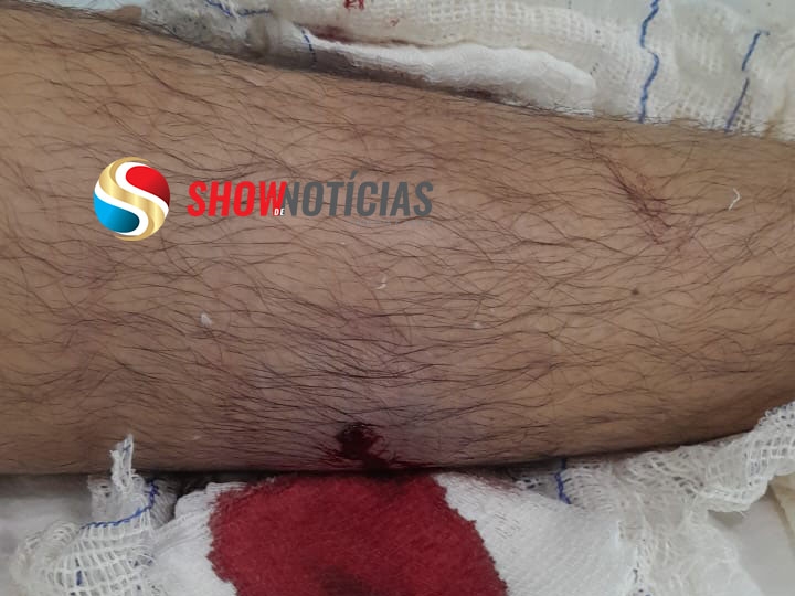 Adolescente que levou tiro na perna, disparado por PM, foi transferido para hospital de Sinop.